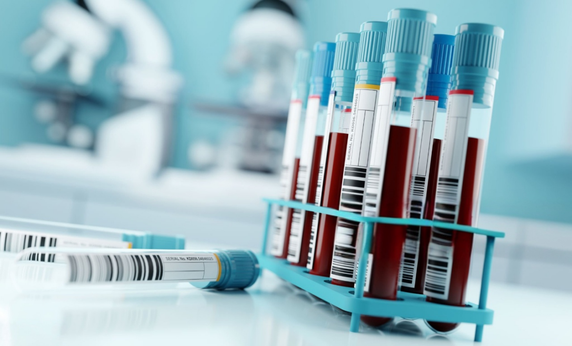 Understanding Your Blood Test Results